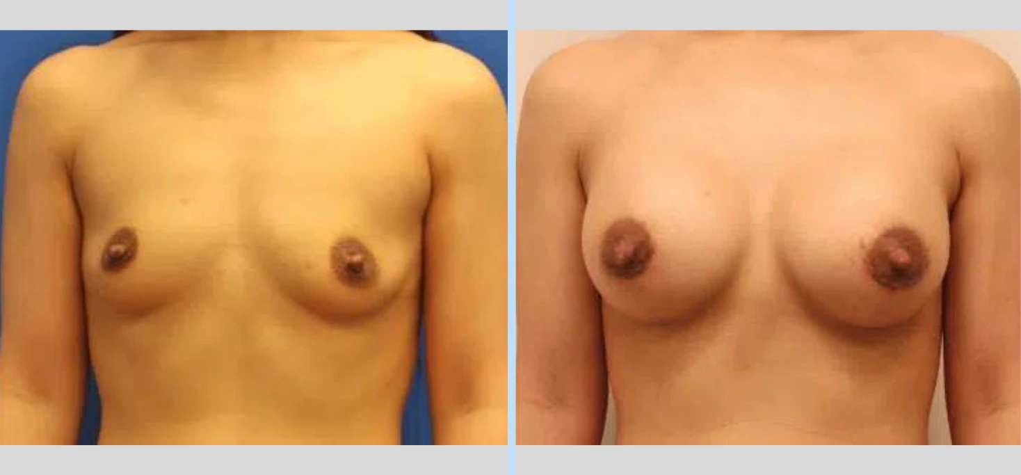 TemplateBefore After (12)