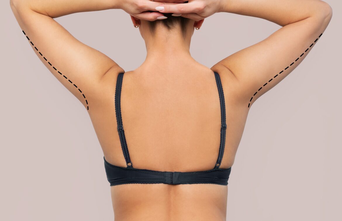About Brachioplasty Banner