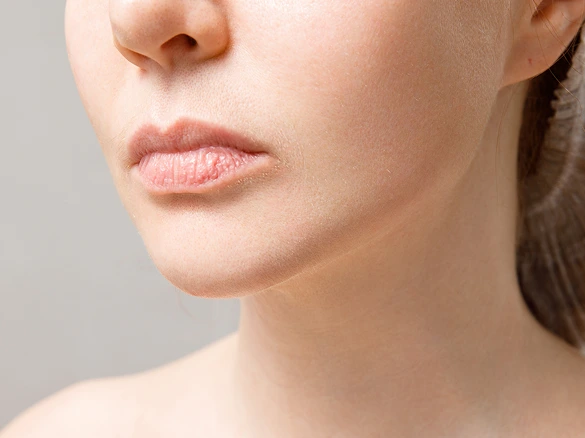 Face Surgery Experts in Philadelphia, PA: Chin Implants